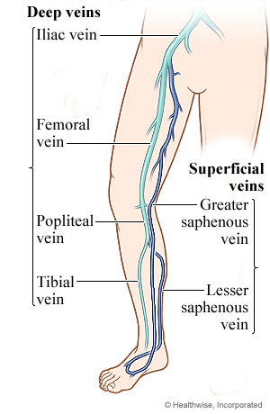 HHCHVIdeepveins.jpg